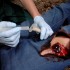 Аппликатор гемостатический с гранулами Rhino Rescue в Одинцово хитозановый