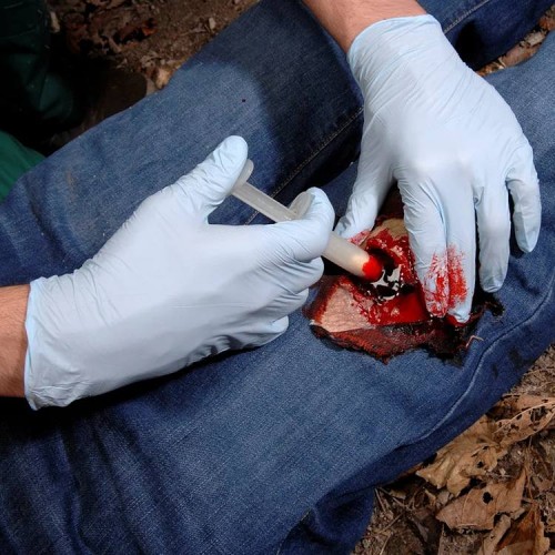 Аппликатор гемостатический с гранулами Rhino Rescue в Одинцово хитозановый
